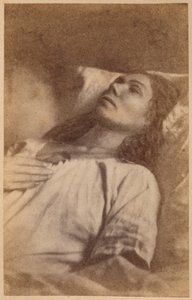 Epilepsia histérica, ataque, fase terminal, ilustração de &39;Iconografia fotográfica de La Salpetriere&39; de Bourneville e P. Regnard, prato XVIII, Paris, 1876 (impressão albumen)