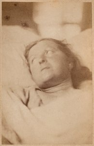 Epilepsia histérica, crucifixão, atitude de cabeça, placa VII de &39;Iconografia fotográfica de La Salpetriere&39; por Bourneville e P. Regnard, Paris, 1876 (albumen print) de Paul Regnard