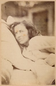 Epilepsia histérica, delírio, luxúria, apartamento XXXVI de &39;Iconografia fotográfica de La Salpetriere&39; por Bourneville e P. Regnard, Paris, 1876 (albumen print)
