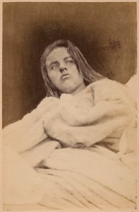 Epilepsia histérica, alucinações, desprezo, placa XXXI de &39;Iconografia fotográfica de La Salpetriere&39; por Bourneville e P. Regnard, Paris, 1876 (albumen print)