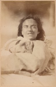 Epilepsia histérica, alucinações, ironia, placa XXXII de &39;Iconografia fotográfica de La Salpetriere&39; por Bourneville e P. Regnard, Paris, 1876 (impressão albumen)