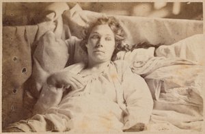 Epilepsia histérica, fase terminal, delírio melancólico, ilustração de &39;Iconografia fotográfica de La Salpetriere&39; de Bourneville e P. Regnard, placa XIX, Paris, 1876 (impressão albumen)