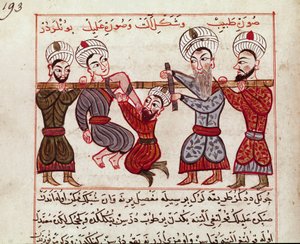 Medicina: intervenção ortopédica. Miniatura retirada de uma ordenha de medicina turca por Charaf-ed-din (Charaf ed Din) (1404-1468) após "La Surgery Imperiale" (Ms Sup Turk 693 fol. 193) 1466 Paris, B.N. de Persian School