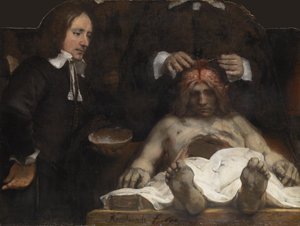 A lição de anatomia do Dr. Jan Deyman, 1656 de Rembrandt van Rijn