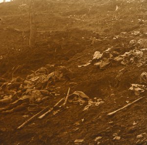 Após o ataque, Les Éparges, norte da França, 1915. de Unbekannt