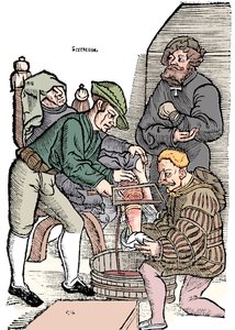 Amputação de uma perna sem anestesia, 1593 de Unbekannt