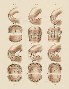 Descrição da placa mostrando a idade, conforme indicado pelos dentes, c1879. de Unbekannt