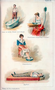 Tratamentos de hidroterapia, c1902 de Unbekannt