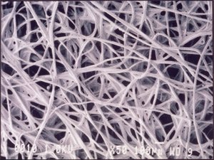 Micrográficos (Luz) Tecido quimotêxtil, micrográfico leve de Unbekannt
