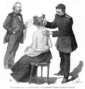 Professor Bergmann injetando um paciente de tuberculose, 1891 de Unbekannt