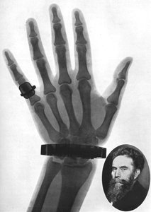Fotografia de raio X de uma mão, 1926 de Unbekannt