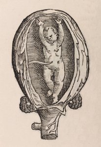 Partus non naturalis manibus funra canut porrectie de Unbekannt