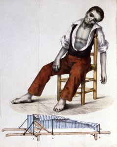Doente com cólera de Unbekannter Künstler