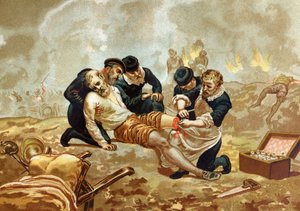 Ambroise Pare Medicin e cirurgião francês (c. 1509-1590) pratica ligadura de arteres após amputação. de após hombres y Mujeres celebres. Barcelona 1877. de Unknown artist