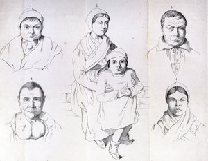 Considerações sobre as causas do cretinismo endémico de Morel. de Unknown artist