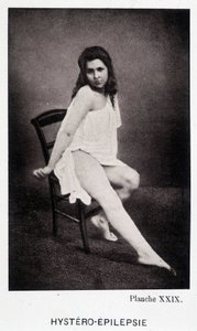 Hystero Epilepsie - Contractura em "Iconografia fotográfica da Salpétrière: serviço de Mr. Charcot" de Paul Regnard e Bourneville de Unknown artist