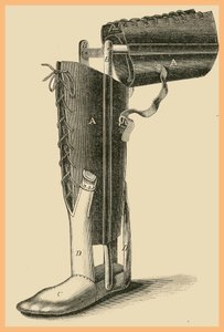 Beinersatz von Unknown Artist