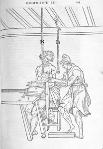 Redução de fracturas. Placa ilustrada de "De dissectione partium corporis humani lbri tres... "por Carlo Stefano Riverio, Paris 1545. de Unknown artist
