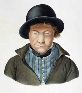 Leprosos da Islândia, cerca de 1840, B.N. de Unknown artist