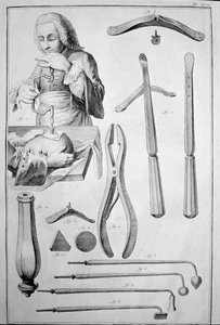 Trepanação do crânio, vários instrumentos (gravura de Unknown artist