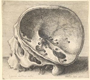 Crânio seccionado em perfil para a esquerda com o lado esquerdo do crânio removido, 1651. de Wenceslaus Hollar