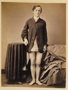 Soldado G. W. Warrington, Recuperação, sem Amputação, após Fratura da Patela Direita por Arma de Fogo, do Catálogo Fotográfico da Secção Cirúrgica