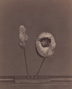 Joelheira Excised Knee Joint. Uma bola de mosquete redonda no côndilo interno do fémur direito [Gardin..., 1866-67].