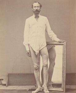 Ferida de bala de terço médio do fémur esquerdo, 1865-67.