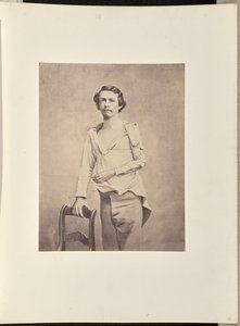 Excisão bem-sucedida da cabeça do úmero esquerdo, seguida de necrose e excisão secundária do restante do úmero e das extremidades superiores do rádio e da ulna de William H. Bell