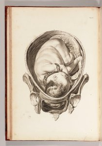 Gravura de uma criança no útero de "Um Conjunto de Tabelas Anatômicas, com Explicações e um Resumo da Prática da Obstetrícia", 1754