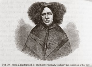Psiquiatria ïInsane mulher de Frederick (attr. to) Barnard