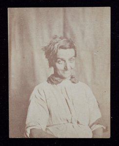 Retrato psiquiátrico de um paciente, Surrey County Asylum, c 1852 de John Pardon