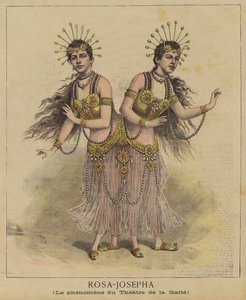gêmeos siameses