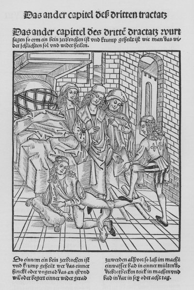 O Livro de Cirurgia de Hieronymus Brunschwig (litho) de (after) German School