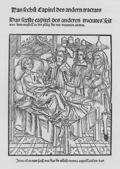 O Livro de Cirurgia de Hieronymus Brunschwig (litho) de (after) German School