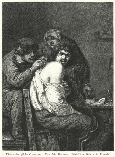 A Operação de Costas de Adriaen (after) Brouwer