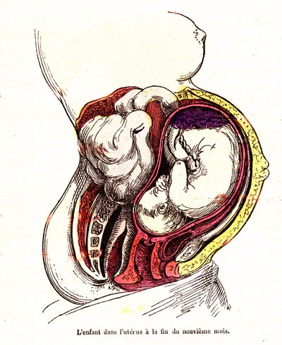 A criança no útero (fim do 9º mês) - A vida normal e a saúde de J. Rengade - Desenho de A. Demarle 1881 de Alphonse Demarle