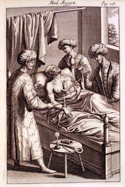 Ilustração de moxabustão de Medicina Aegyptorum por Prospero Alpinus, 1745 de American School