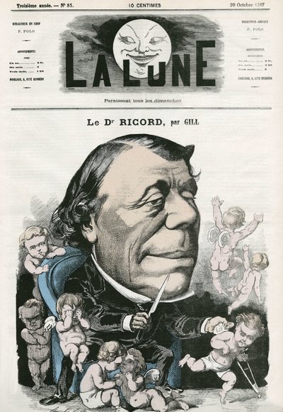 Retrato do Dr. Ricord, médico francês. Cartoon de Gill, em "La Lune", 20 de outubro de Andre Gill