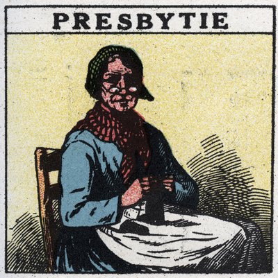 O olho: pessoa que sofre de presbiopia. Ilustração anônima de 1925. Coleção privada. de Anonymous Anonymous