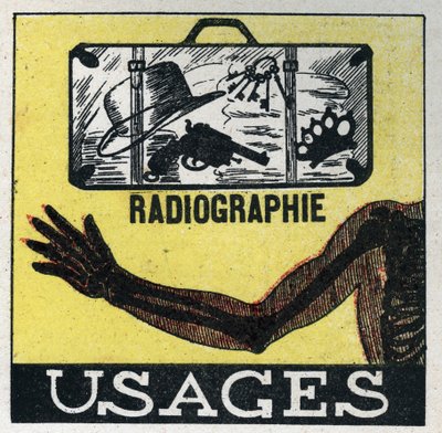 Raios-X: utilização de raios-X para ver através de objectos e corpos. Ilustração anónima a partir de 1925. Coleção privada. de Anonymous Anonymous