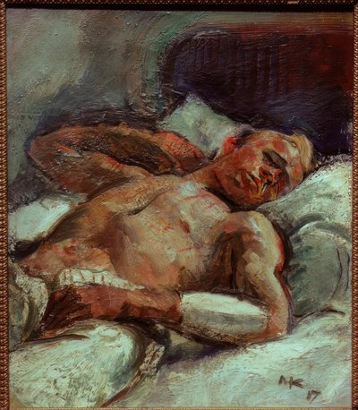Ferido de Anton Kolig