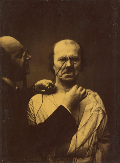 Agressão, maldade, 1854-1856, impresso em 1862. de Duchenne de Boulogne