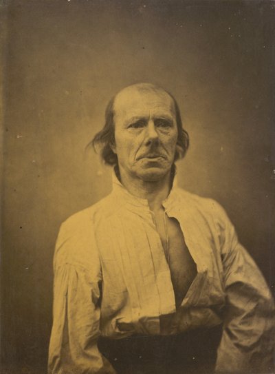 Rosto em repouso, 1854-1856, impresso em 1862. de Duchenne de Boulogne