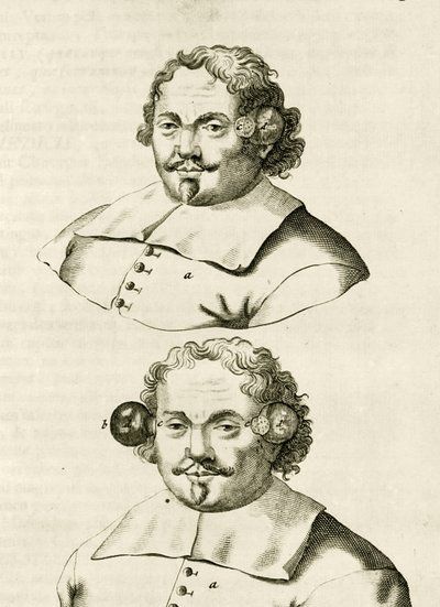 Um exemplo de escavação, a partir dos exercícios práticos para curar método por Frederic Dekkers, 1694 de Dutch School