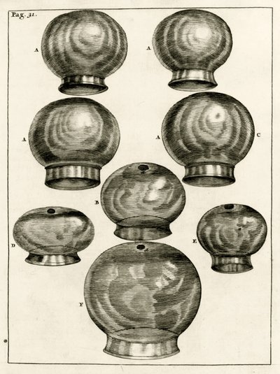Vários ventosas, desde os exercícios práticos para curar método pelo Frederic Dekkers, 1694 de Dutch School