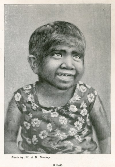 Krao, The Missing Link, exibido no aquário, Westminster, Londres, em 1887 de English Photographer