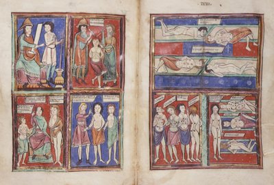 Sloane 1975 fol.91v-92 Cenas médicas de English School