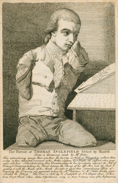Thomas Inglefield, nascido em 18 de dezembro de 1769 em Hook, Hampshire, sem braços ou pernas de English School