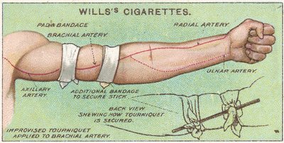 Torniquete, no.11 da série de primeiros socorros de cartões de Willss Cigarettes, 1913 de English School